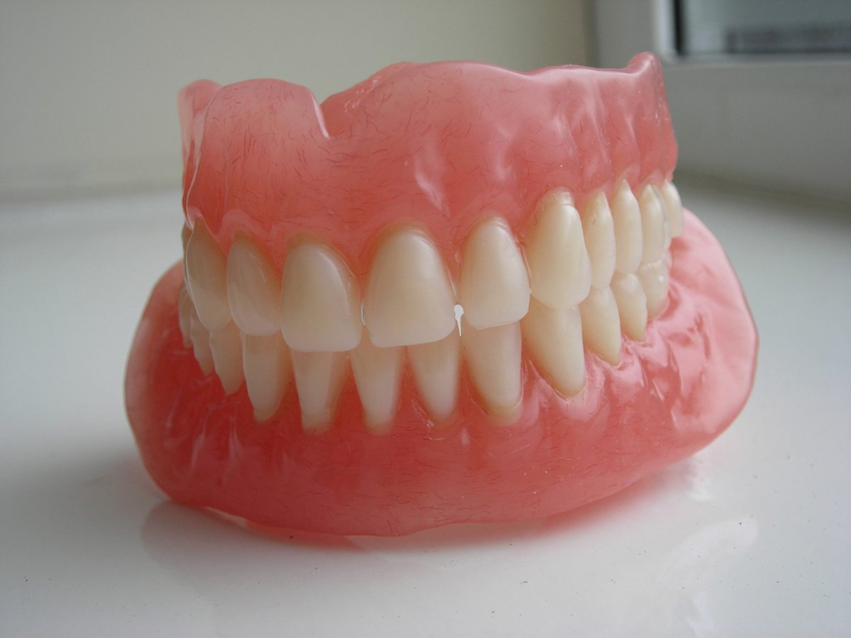 Full acrylic denture crafted at Ballina Dental Laboratory